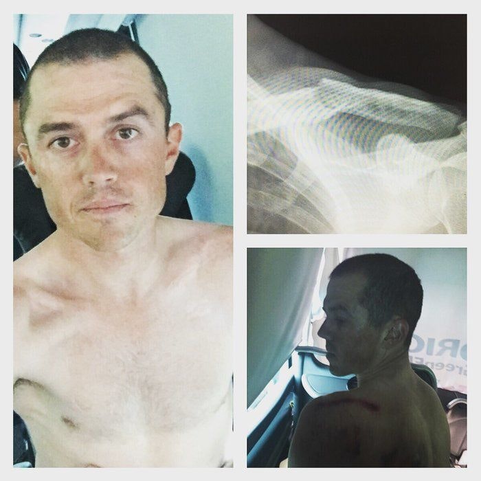 Simon Gerrans broken collarbone Tour de France 2016 BikeExchange
